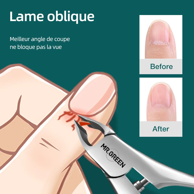 Pince Cuticule Professionnel